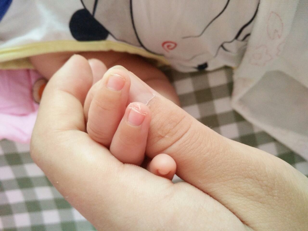 孩子指甲有白斑、凹陷 應(yīng)該補(bǔ)哪些微量元素